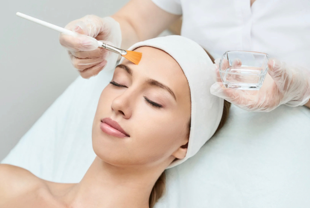 Series of 4 Chemical Peel