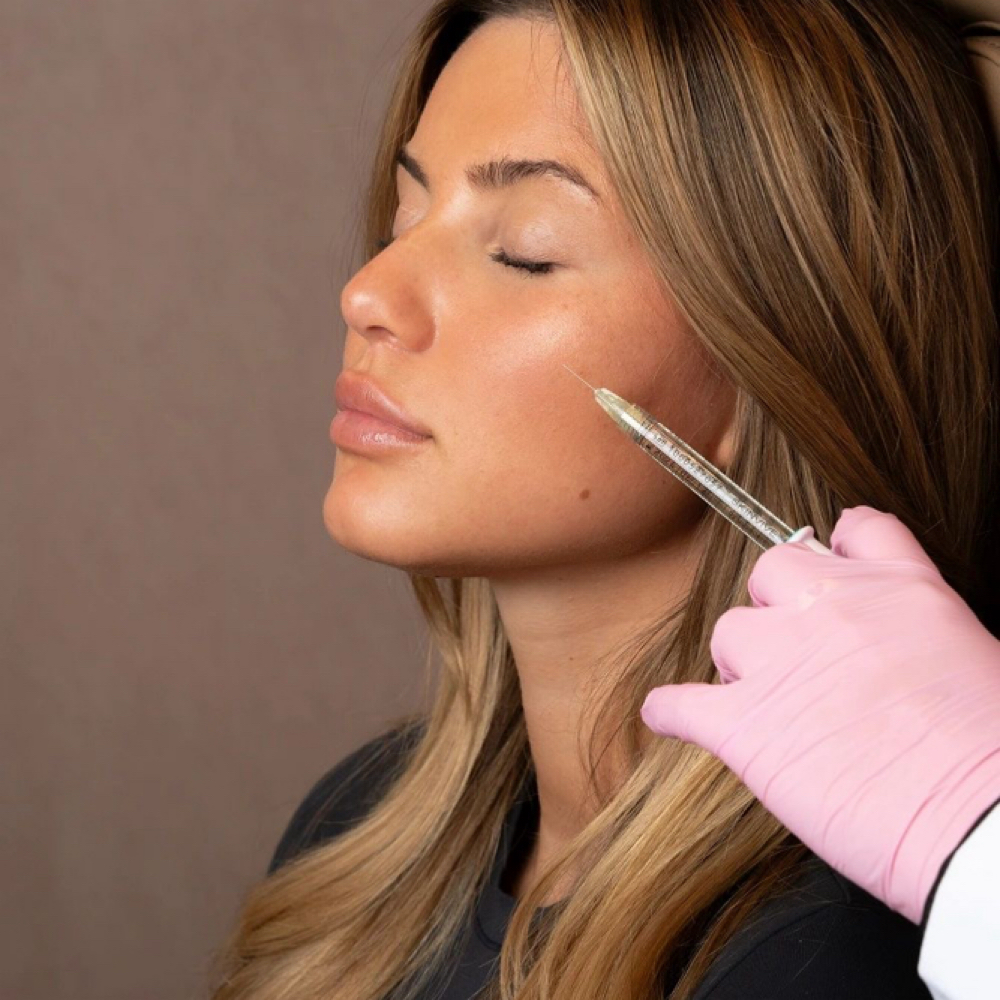 Cheek Filler at Beauty Lounge Prosper in McKinney, TX