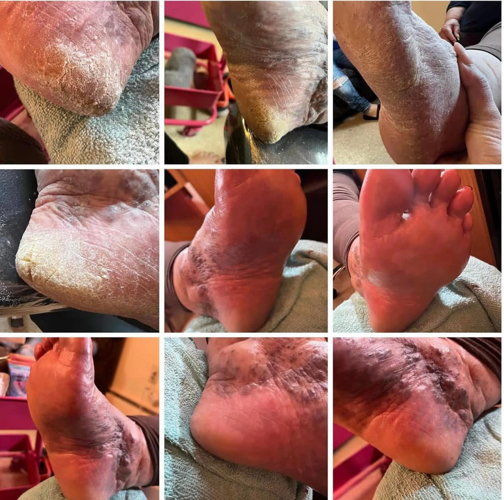 Pedicure at VG Nails in SAN Antonio, TX