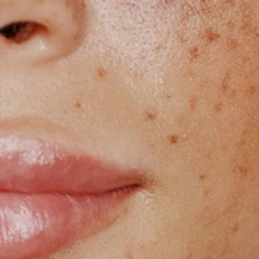 Freckles + beauty marks at The Rebrand Room at Branded Beauty Suites in Upland, CA