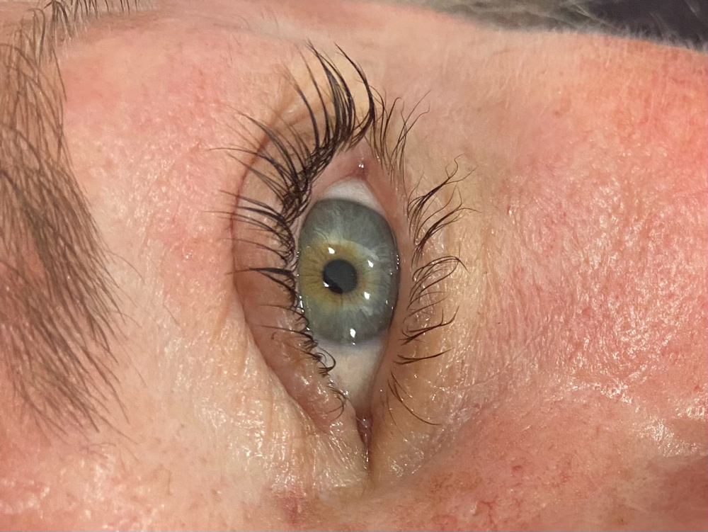 Lash lift