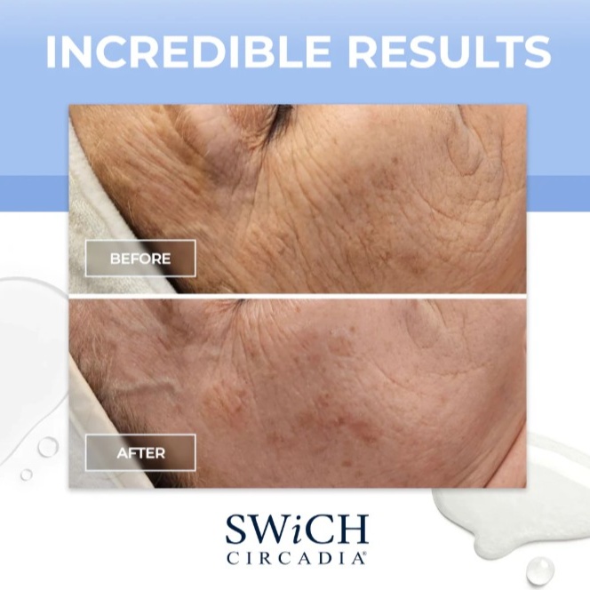 ATP Age Defy Therapy at Affinity & Glow Aesthetics in Royal Oak, MI