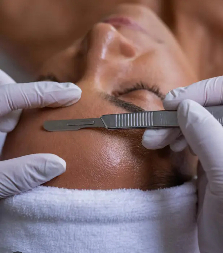 Dermaplaning Treatment Add On