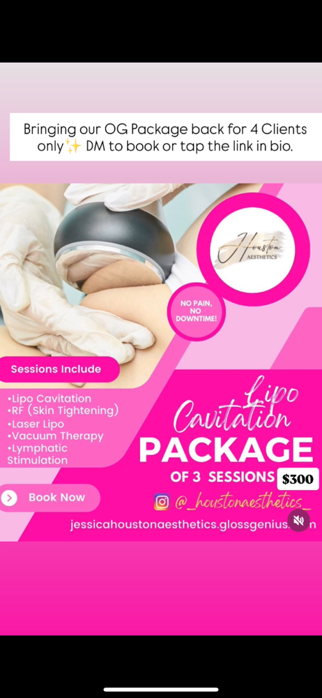 Custom Lipo Pkg 3 Treatment