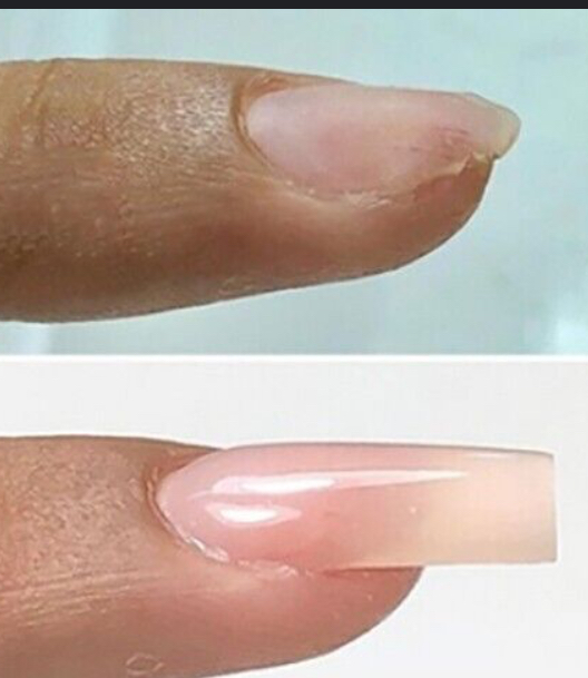 Nail Repair