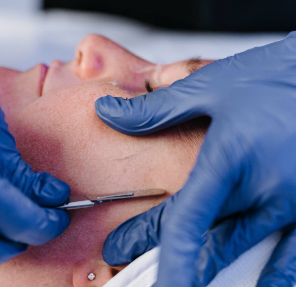 Dermaplaning Deluxe Facial