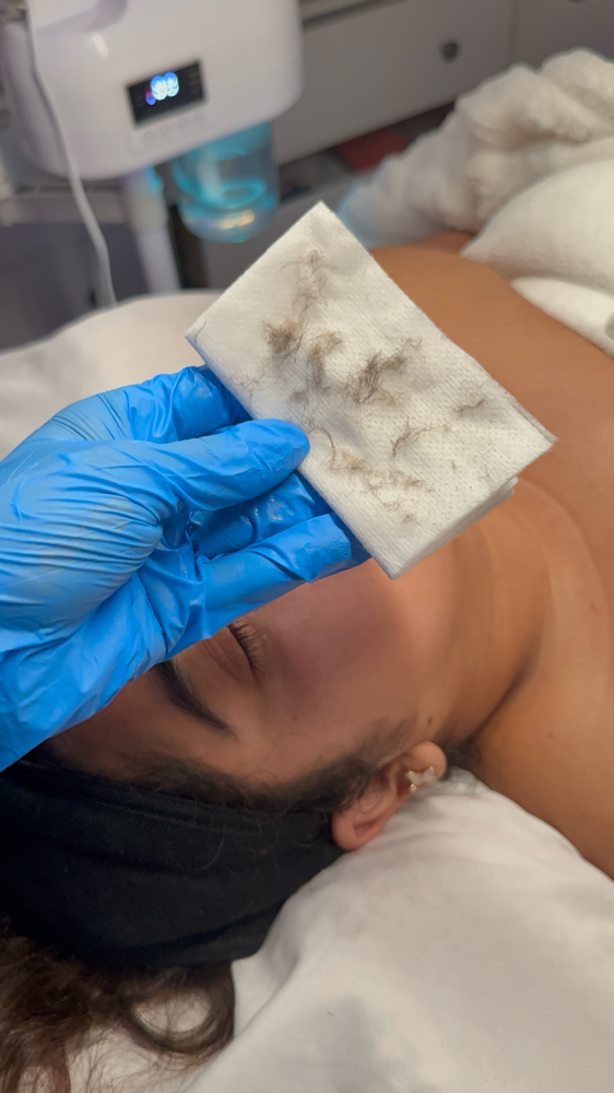 Dermaplaning Deluxe Facial at Nikki Lee Esthetics in Pearland, TX