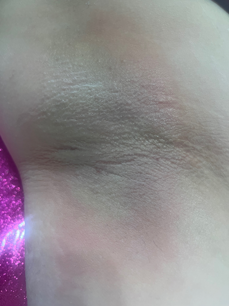 Underarms