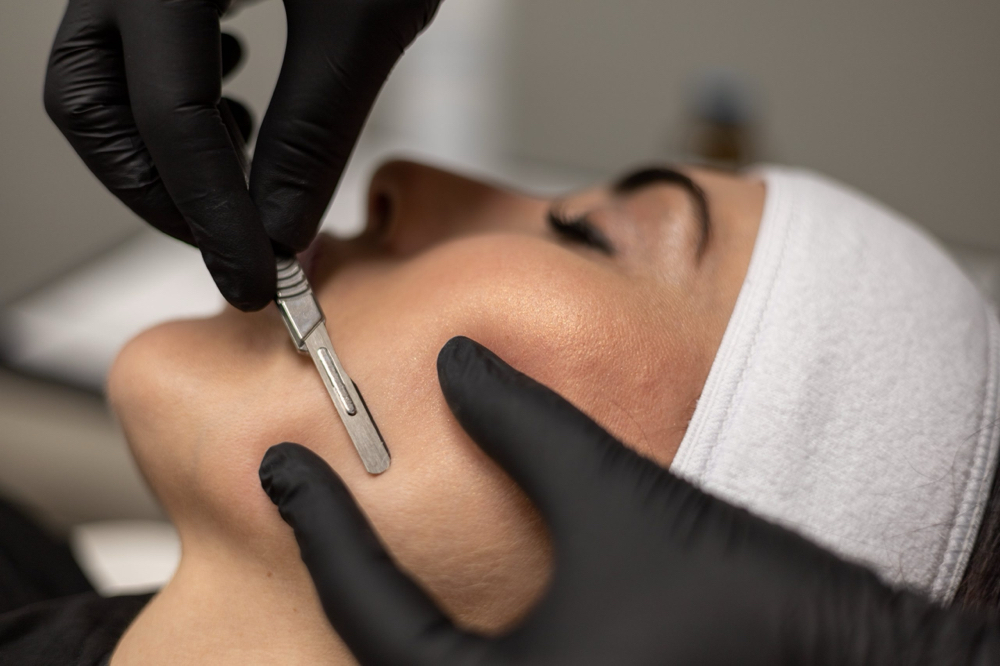 Dermaplane Add-On