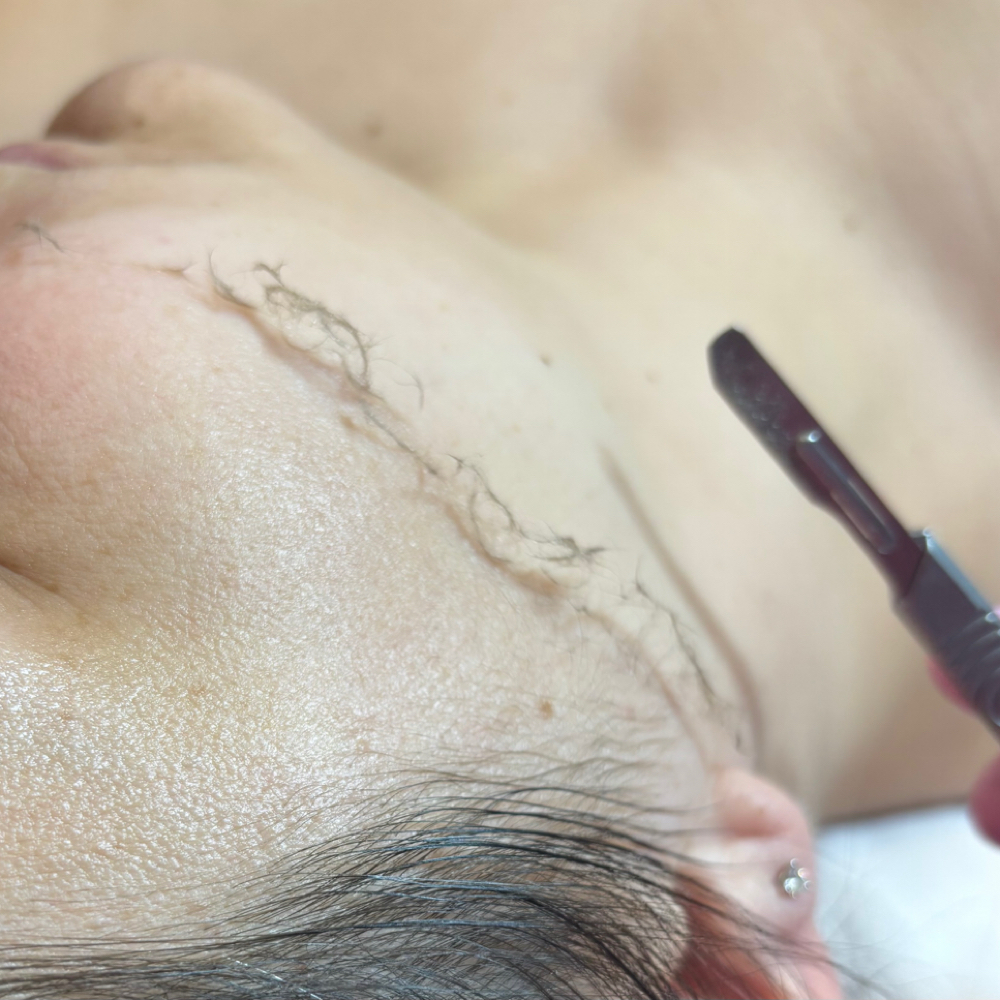 Dermaplane at Serene Gatherings