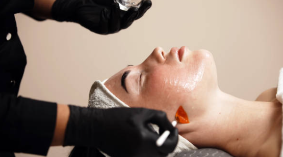 Vitamin A Renewal Chemical Peel