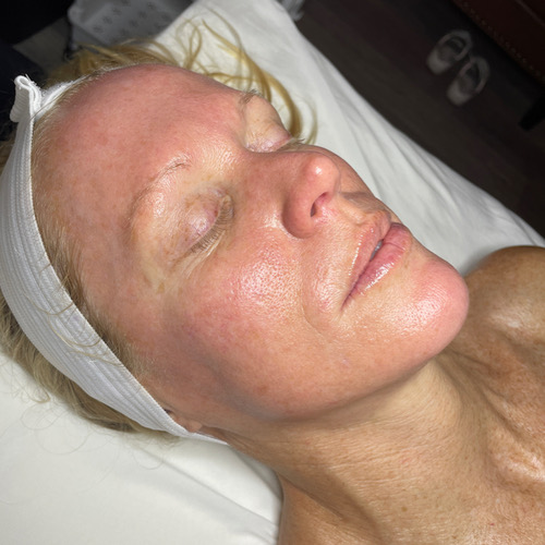 Deluxe Custom Facial