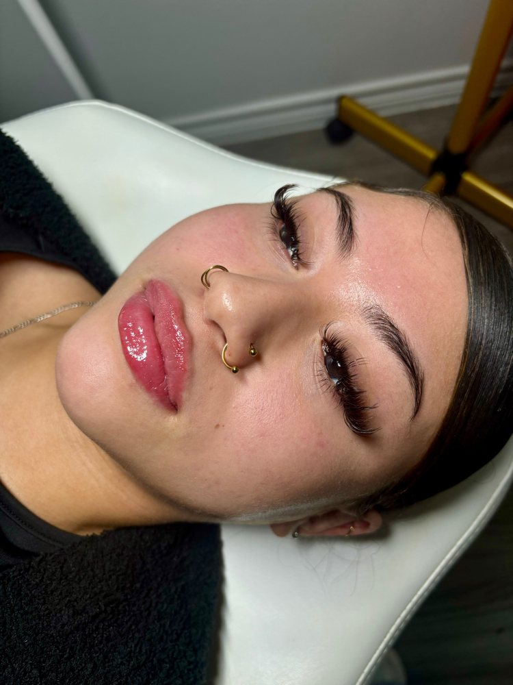 Lips + Smile Lines Combo