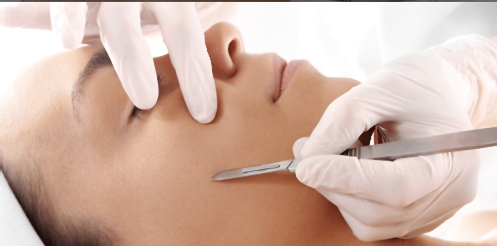 Dermaplaning