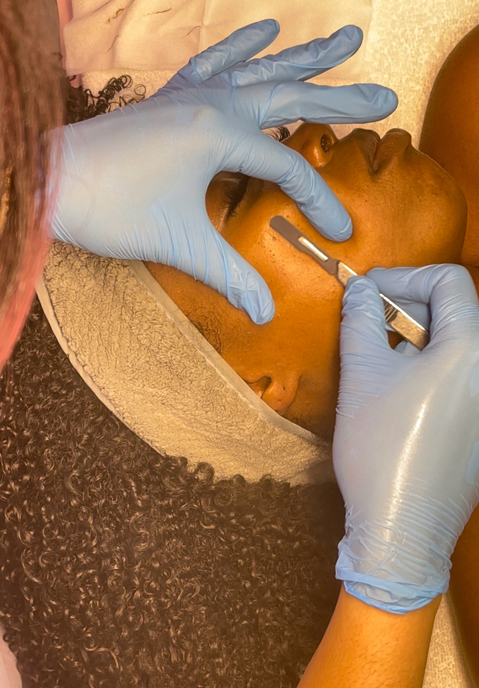 Dermaplaning Facial