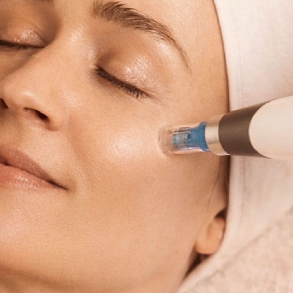 Microneedling at Arcana Med Spa in Castle Rock, CO