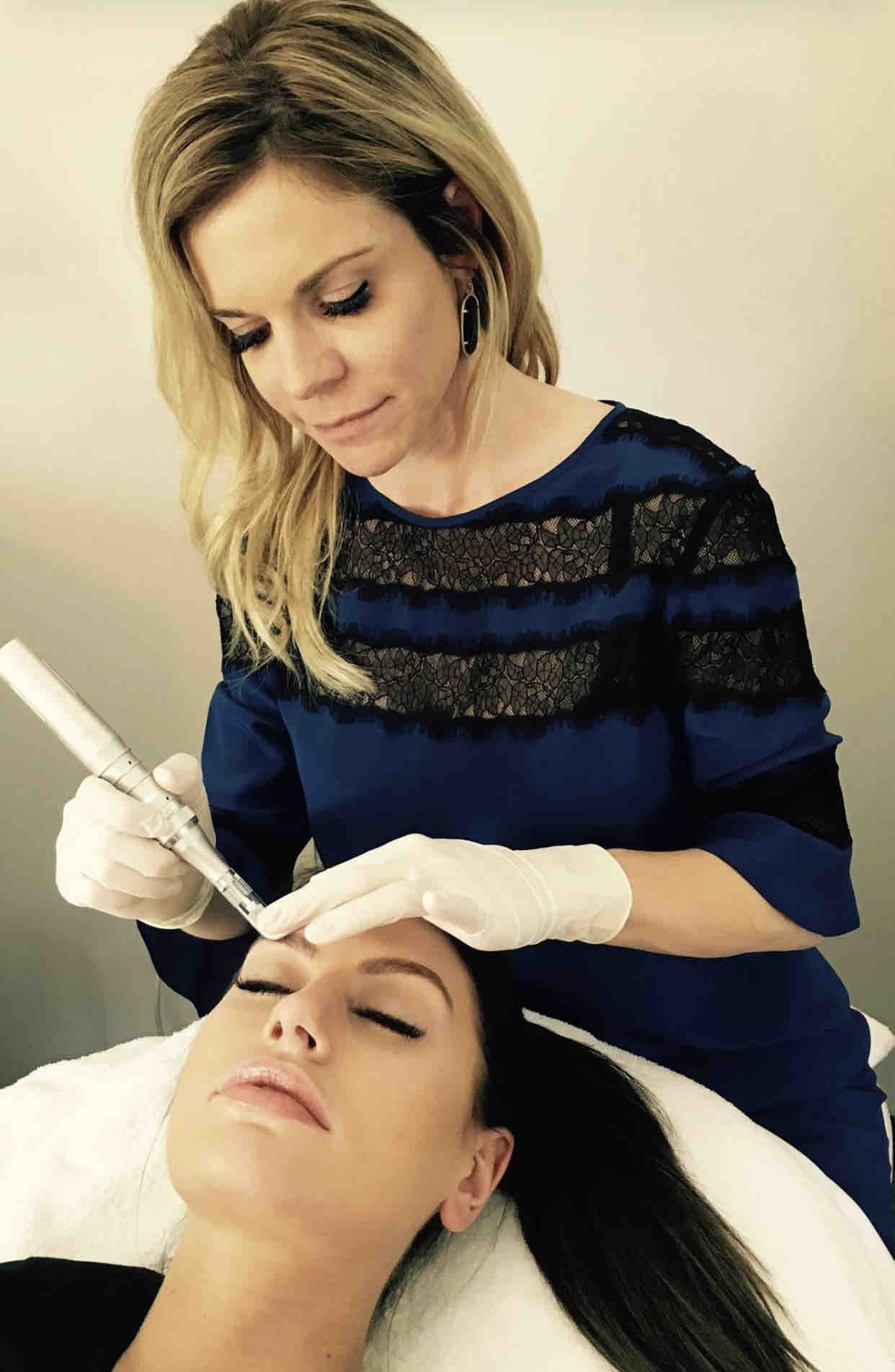 Microneedling