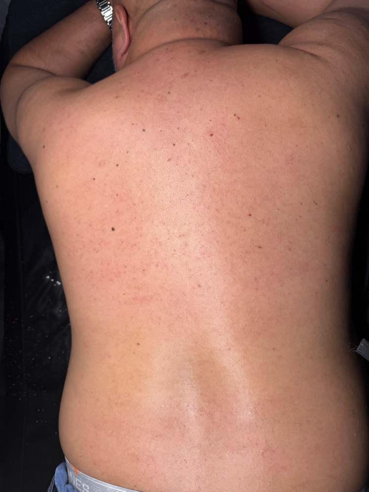 Full Back Wax
