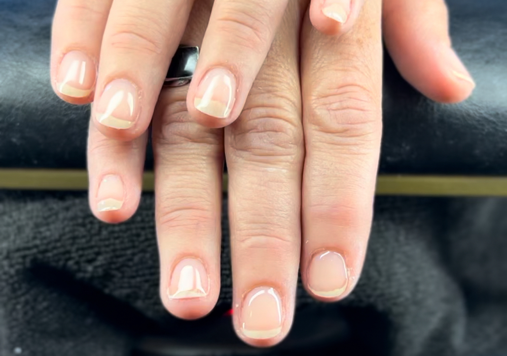 Structured Hard Gel Overlay