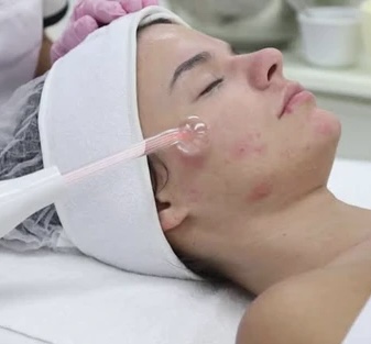 Acne Facial Stage 1