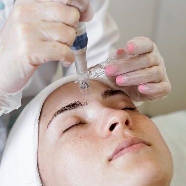 ANTI-AGING [Microneedling]