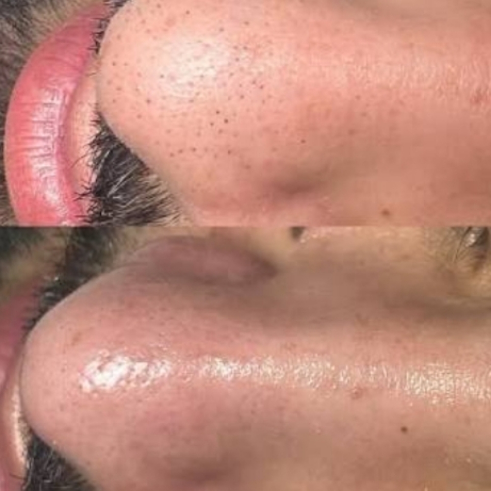 Mens Facial at Miah Worthwhile in San Antonio, TX