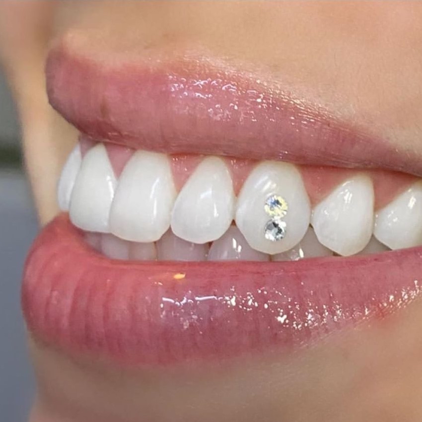 Swarovski Tooth Gems