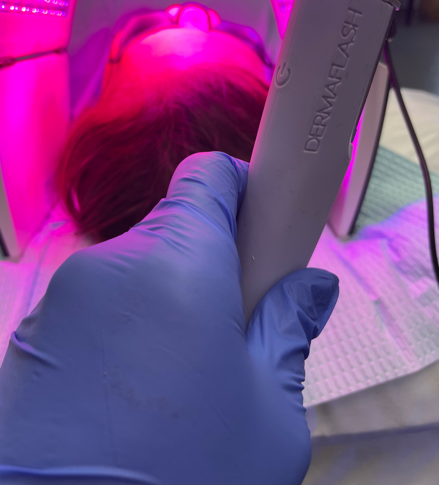 DERMAFLASH® Luxe+