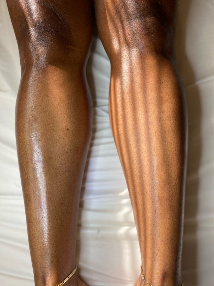 LOWER LEGS