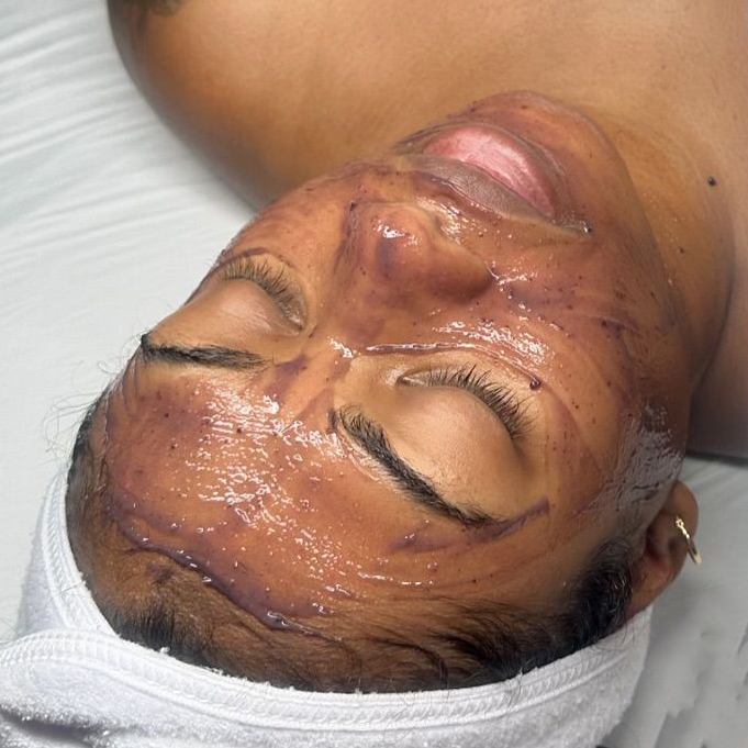 Lactic Berry Peel Facial