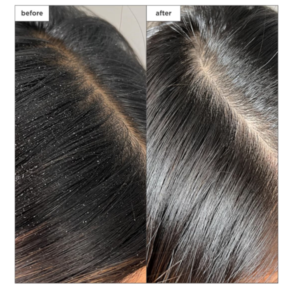 DRY SCALP TREATMENT BLOWOUT π at DINADOESGLAM in Philadelphia, PA
