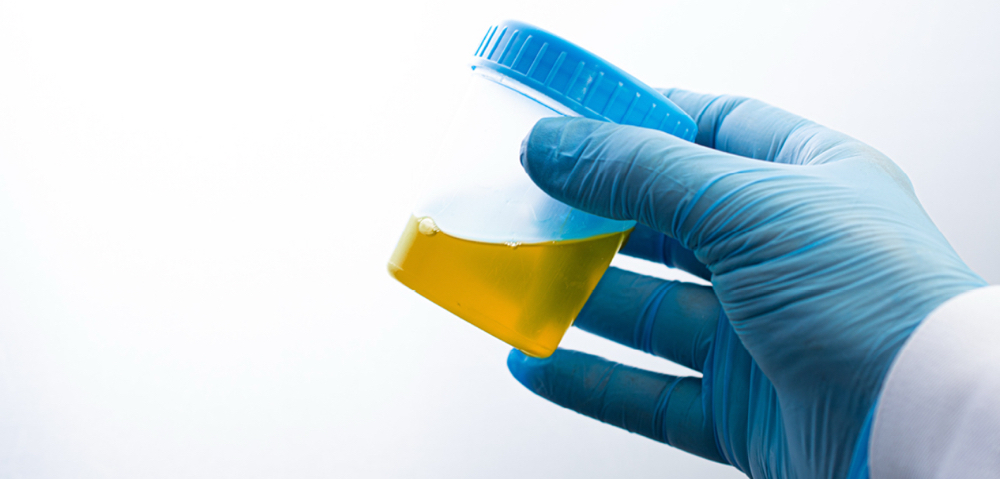 Urine Collections- In Clinic