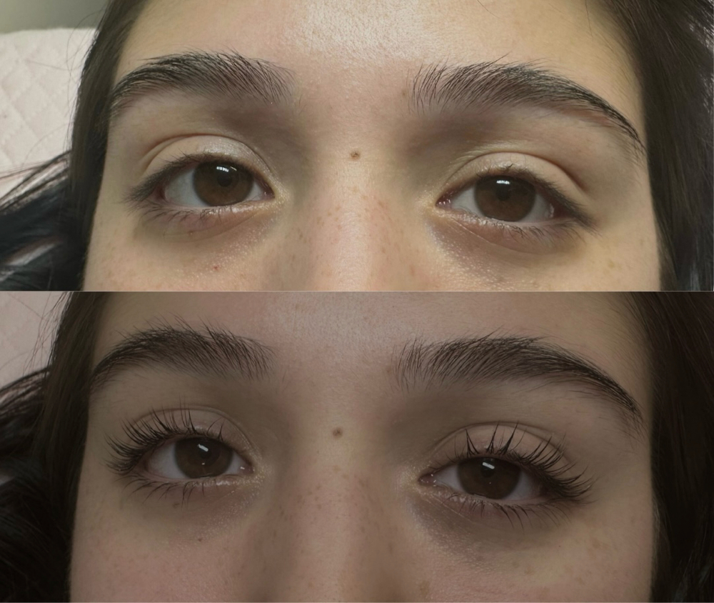 Eyelash lift