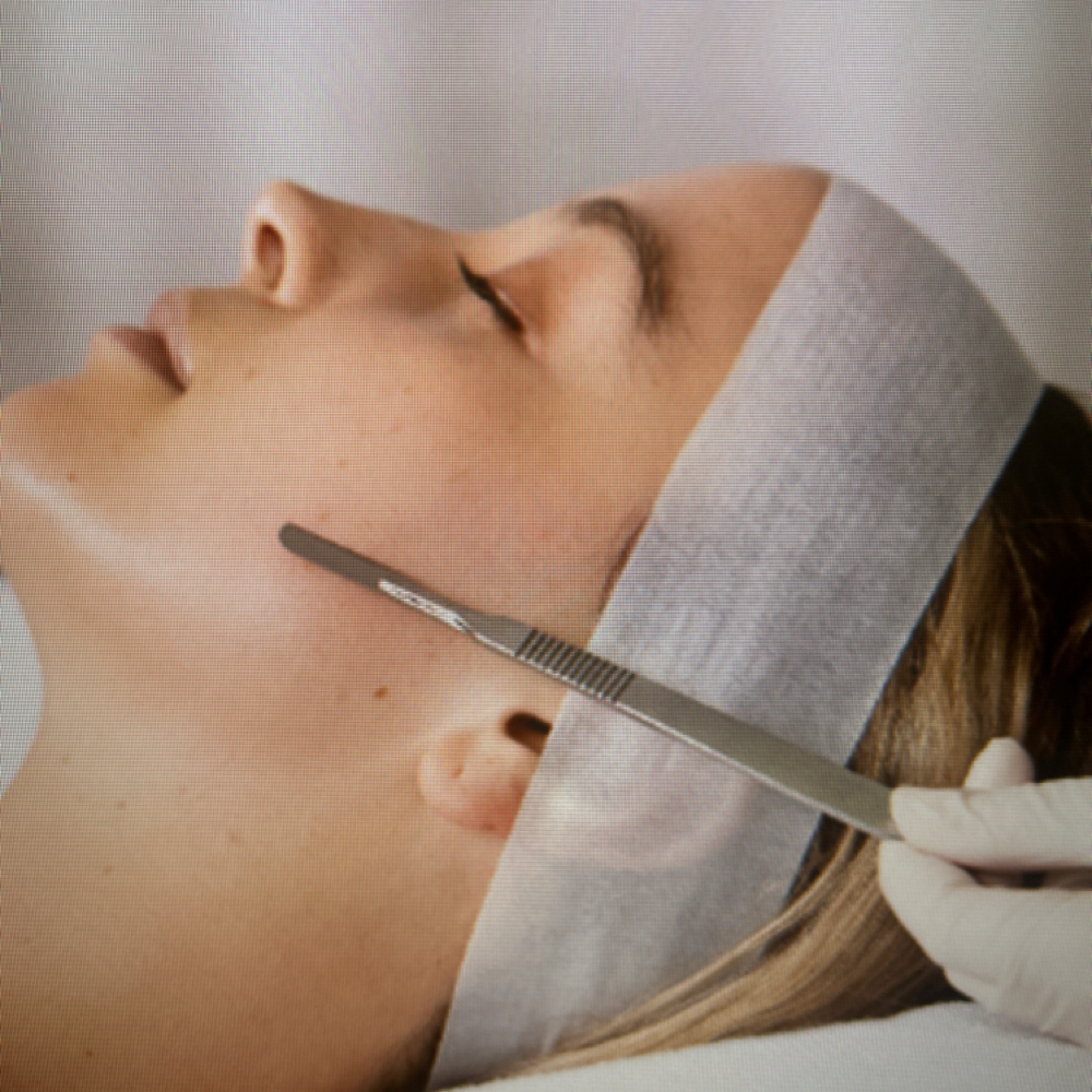 Dermaplaning- Add On at Riverwalk Esthetics in Owensboro, KY