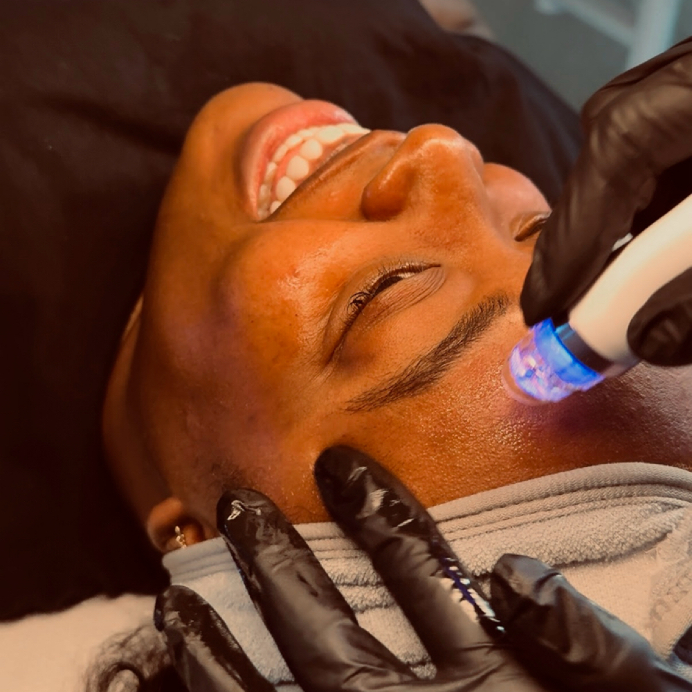 Hydrodermabrasion (Hydrofacial) at Refinery Aesthetics Loft in Oxon Hill, MD