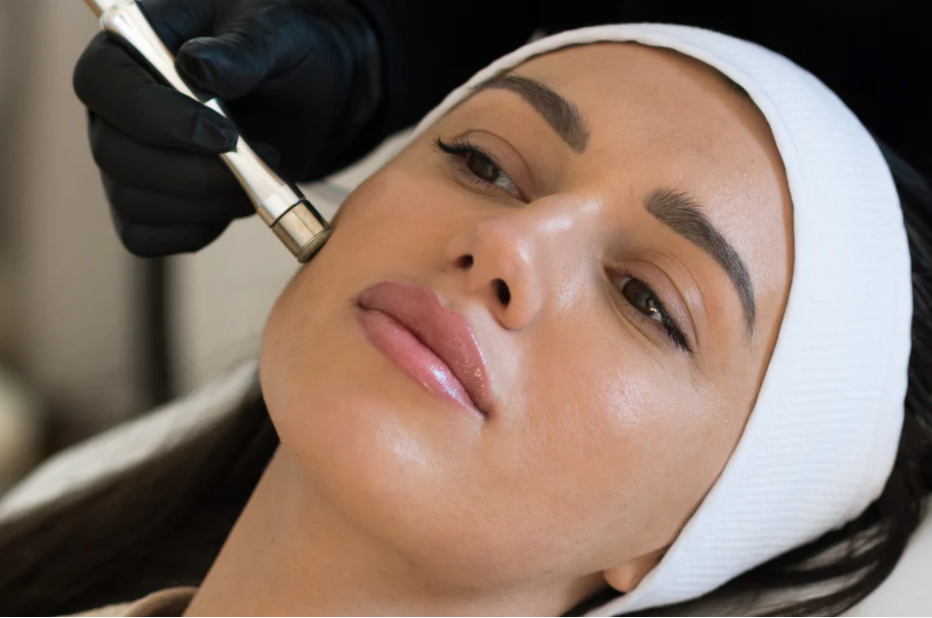 Microdermabrasion Treatment