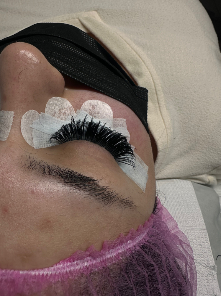 Hybrid Refill