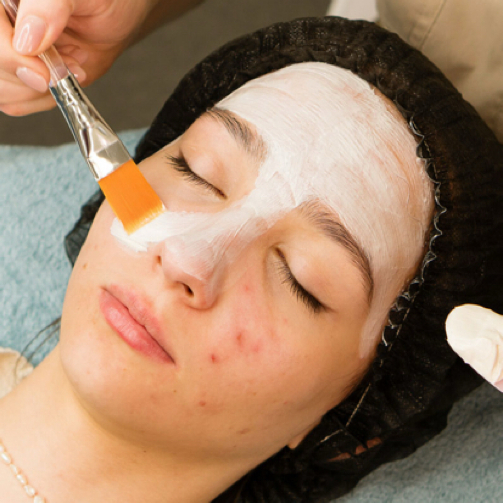 Acne Clearing Facial at Archer Aesthetics in Saraland, AL
