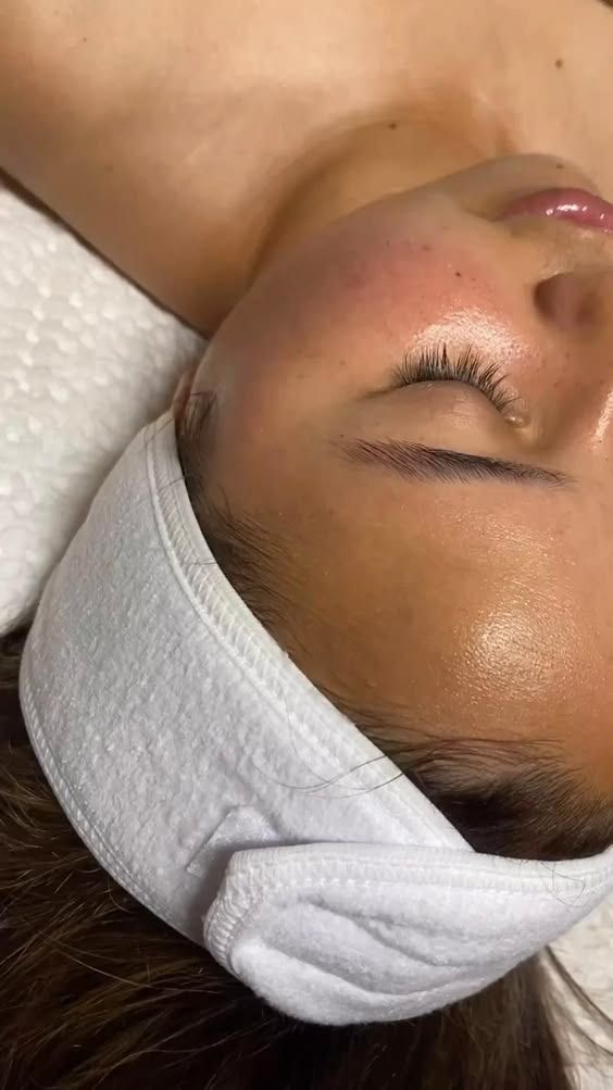Skin Consultation at Refined Radiance - By Bay in South Jordan, UT