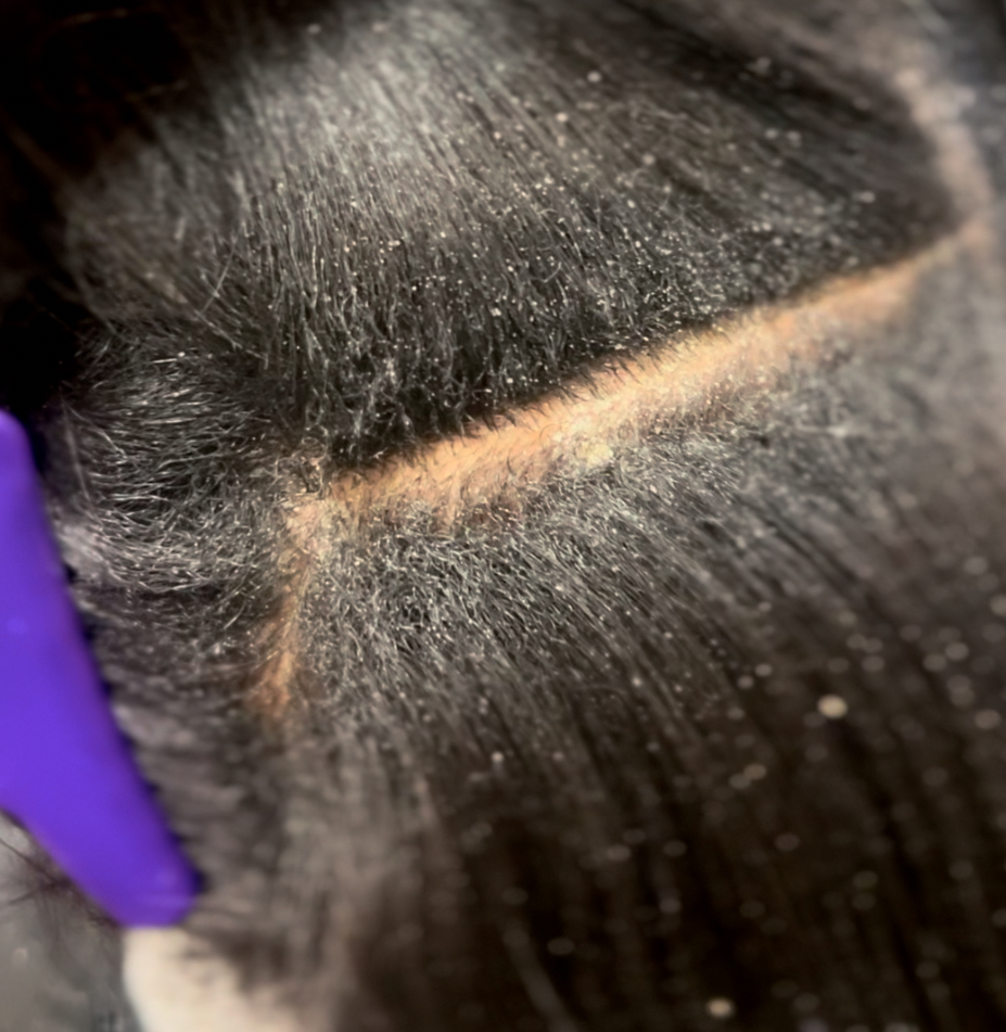 Hair Scalp Detox Treatment