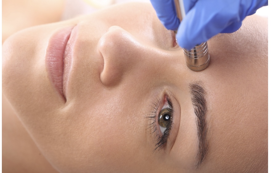 Microdermabrasion