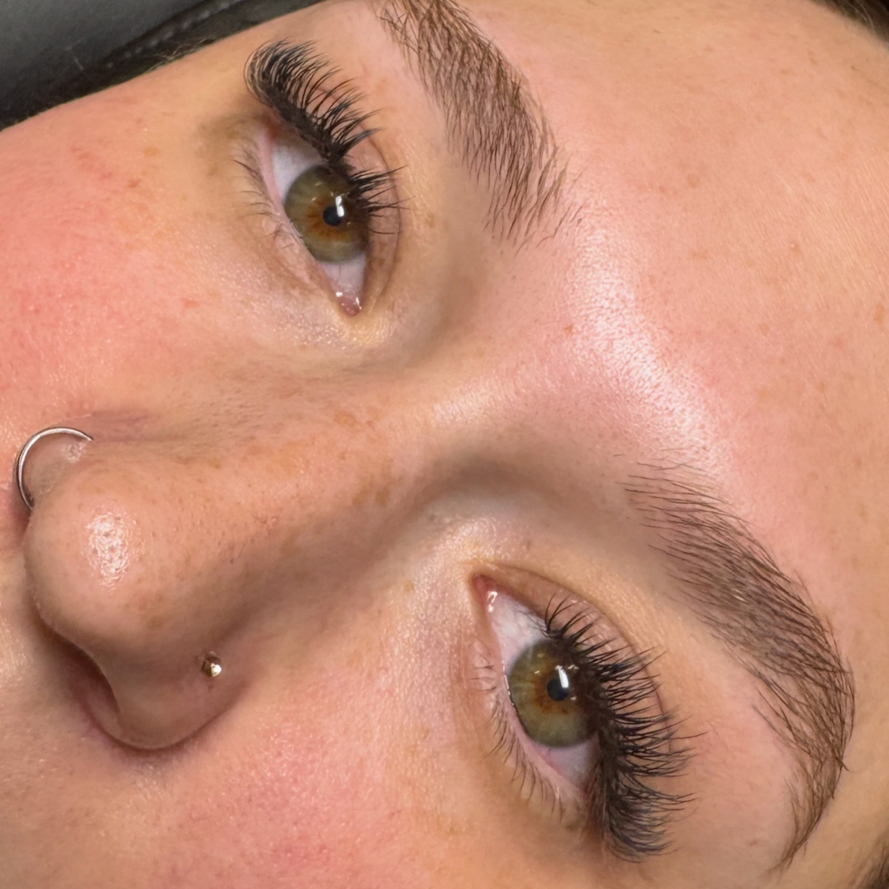 Classic Fill at Esthetics By Katina in Longview, WA