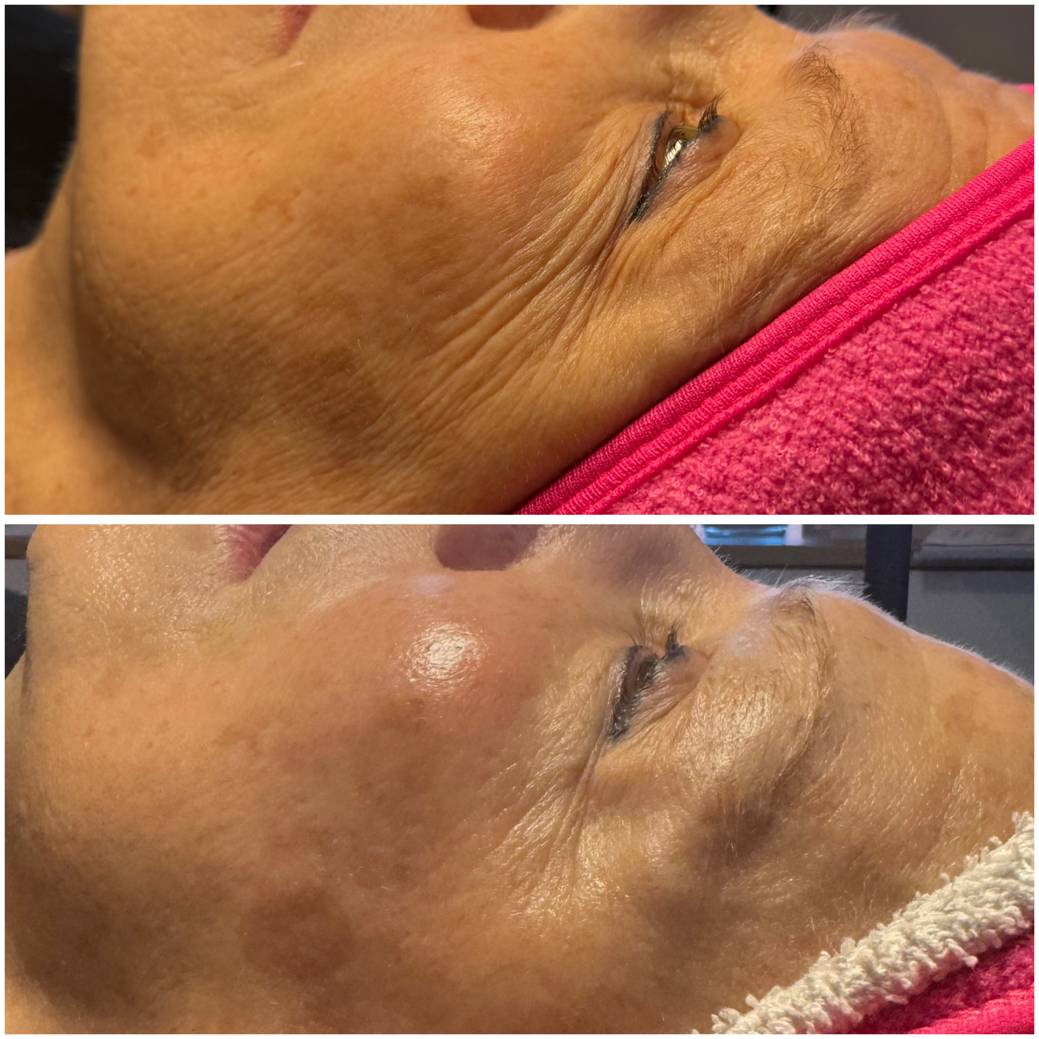 Advanced Firming Facial