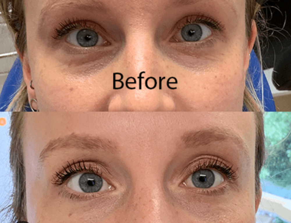 JALUPRO® YOUNG EYE