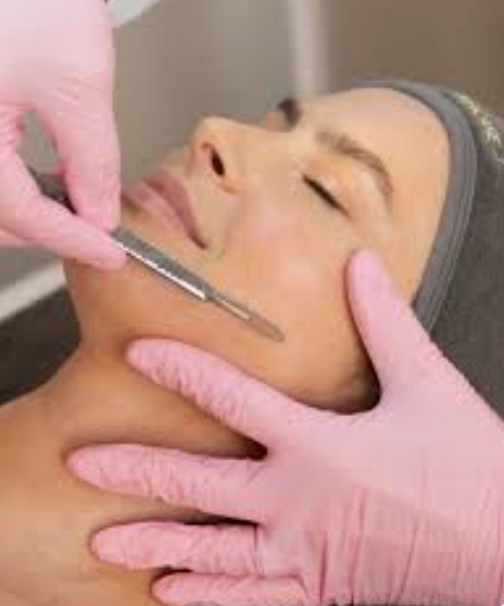 Dermaplaning