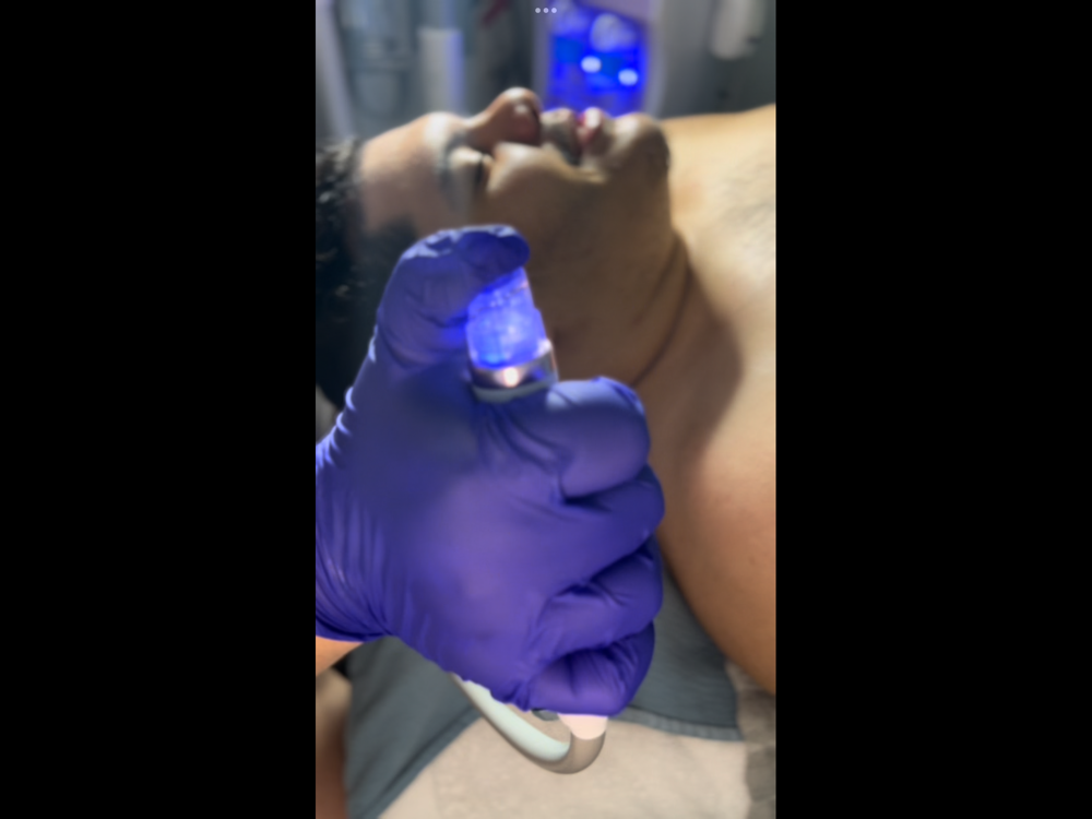 Custom Hydrodermabrasion Facial at Ethereal Skin x Jenn in Bloomfield, NJ