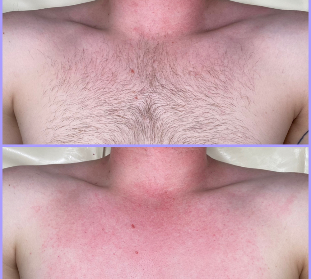 Chest Wax