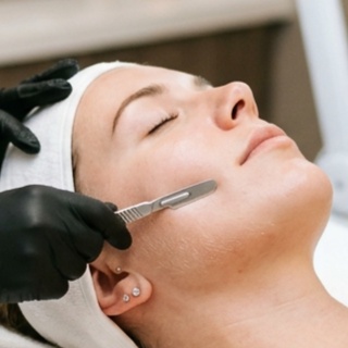 Dermaplaning at Ana Hassan in Sacramento, CA