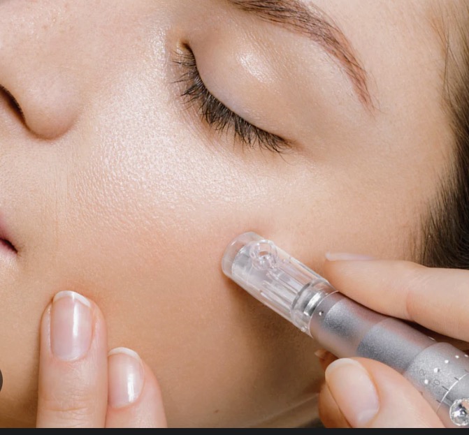 Microneedling Facial Treatment