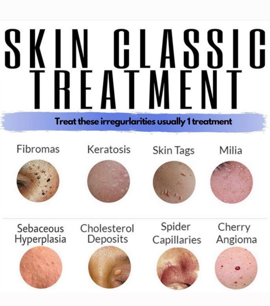 Skin Classic